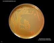 deoxycholate citrate agar pseudomonas
